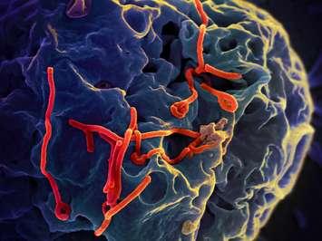 Ebola virus by NIAID via Flickr
